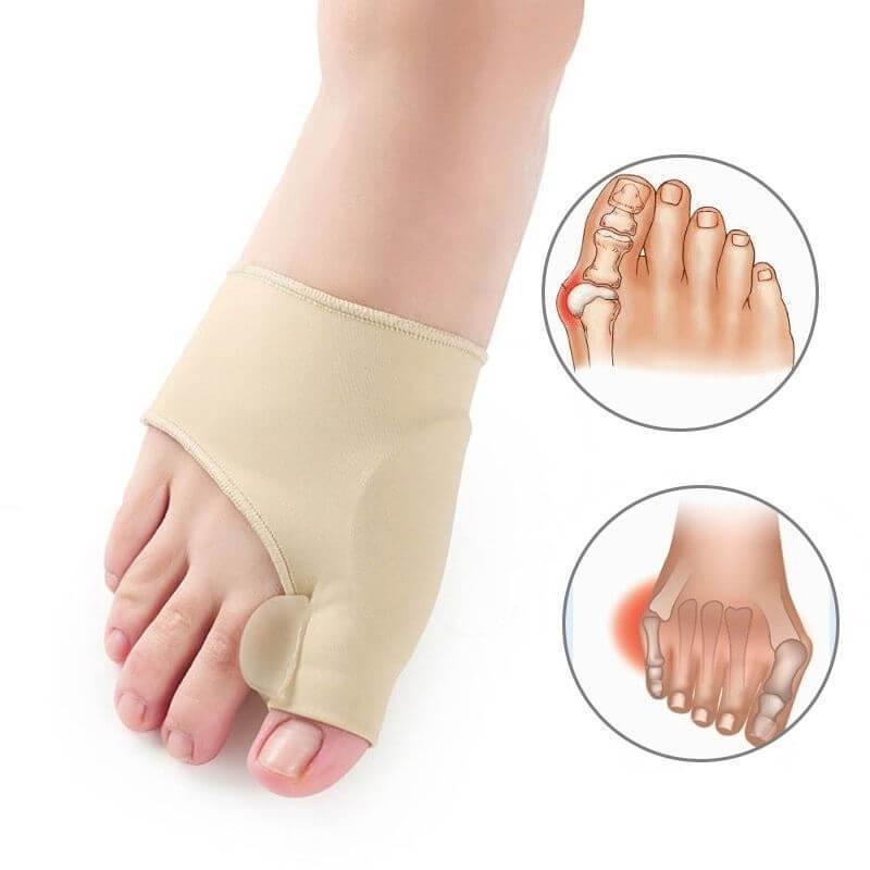 Bunion Top™ - 50%OFF🔥-Corretor  Ortopédico de Juanete (1 Par)